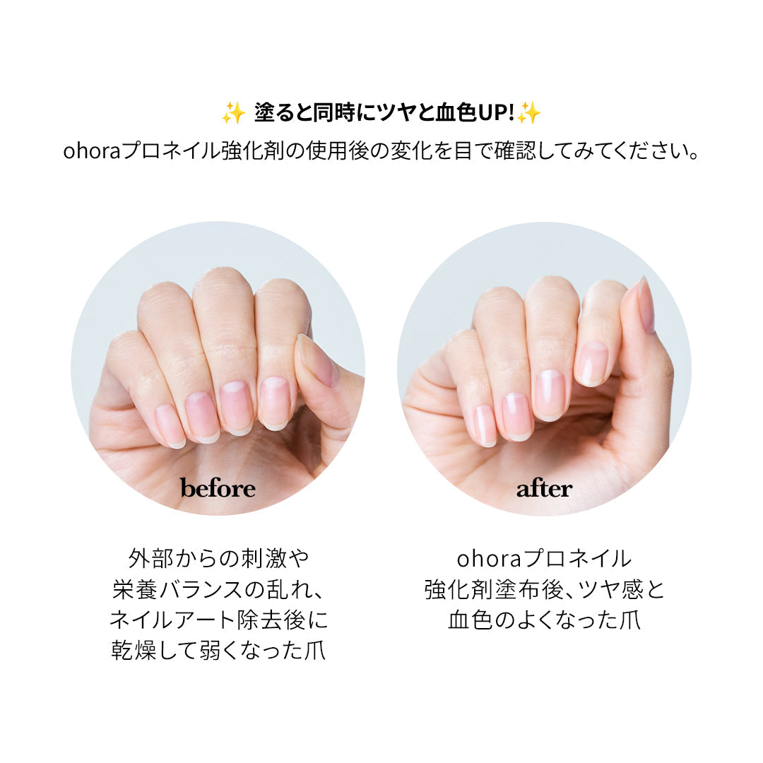 ohora full care set
