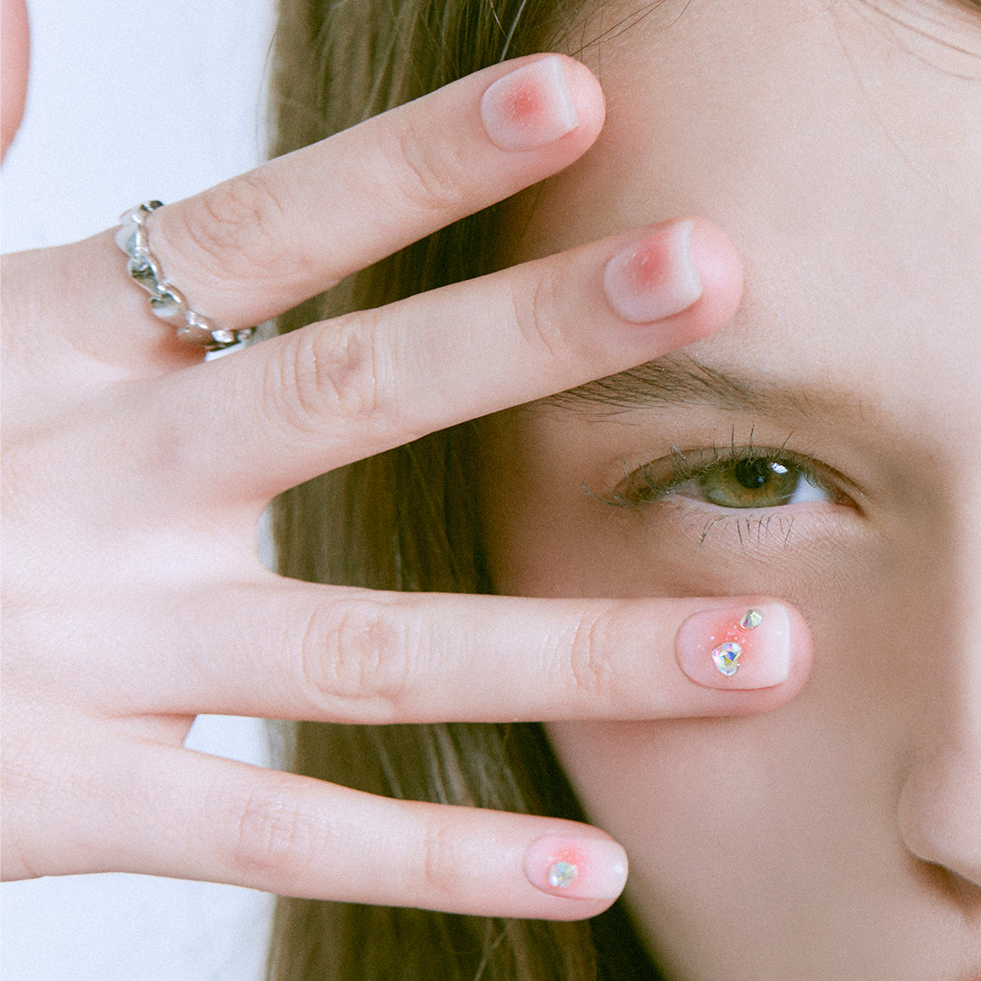 N Freckles