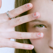 N Freckles